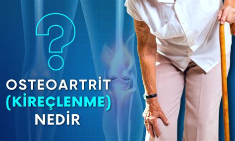 dizde deforme olan osteoartrit için etkili tedavi nedir?